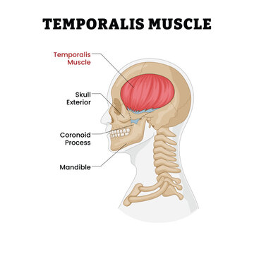 Temporalis Muscle Anatomy labeled diagram, educational head anatomy poster design healthcare scheme, chewing muscle structure attachment. temporalis muscle, skull exterior, coronoid process, mandible