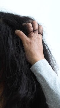 woman has problems with hair and itchy scalp, she has dandruff from allergic reactions to shampoos. and hair conditioner.
