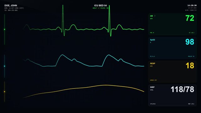 Medical patient monitor screen displaying real time vital signs.