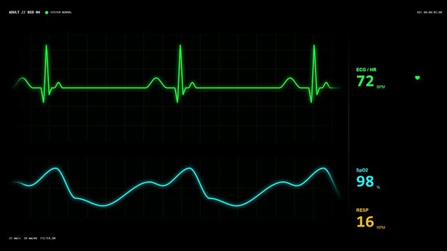 Medical patient vital signs monitor screen showing heart rate and oxygen levels.