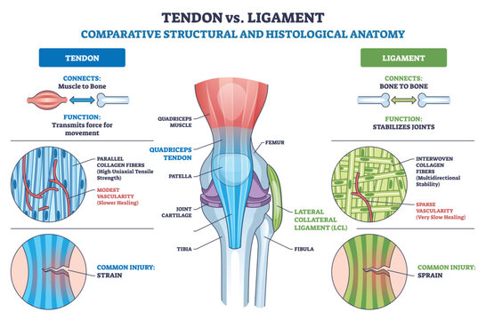 Tendon vs Ligament comparison illustrates muscle-to-bone tendons and bone-to-bone ligaments around the knee, highlighting function, fibers, and common injuries like strain and sprain. Outline diagram
