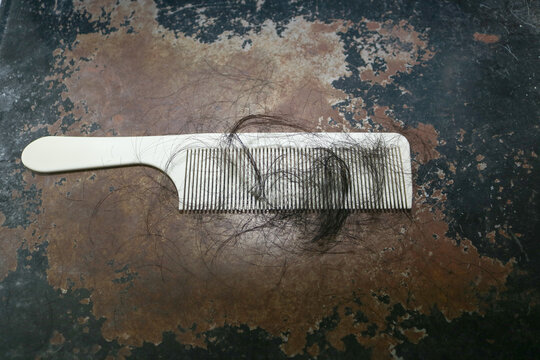 Hair Loss and Excessive Hair Shedding on Comb