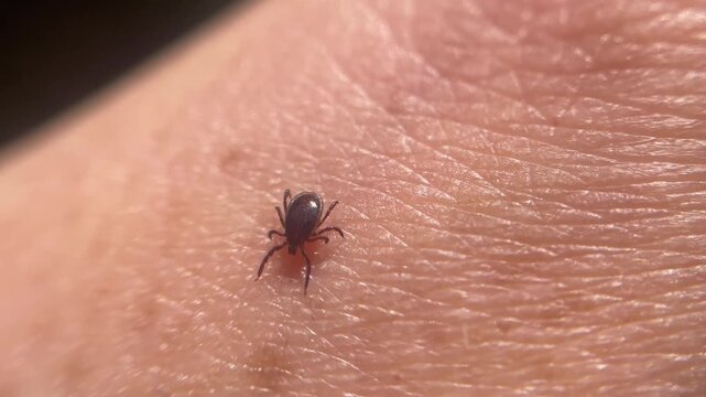 A tick crawling on a person's arm human skin macro close up