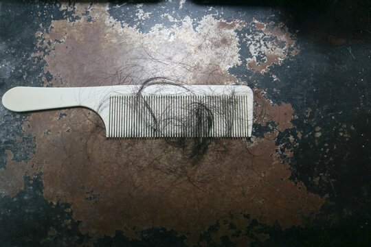 Hair Loss and Excessive Hair Shedding on Comb