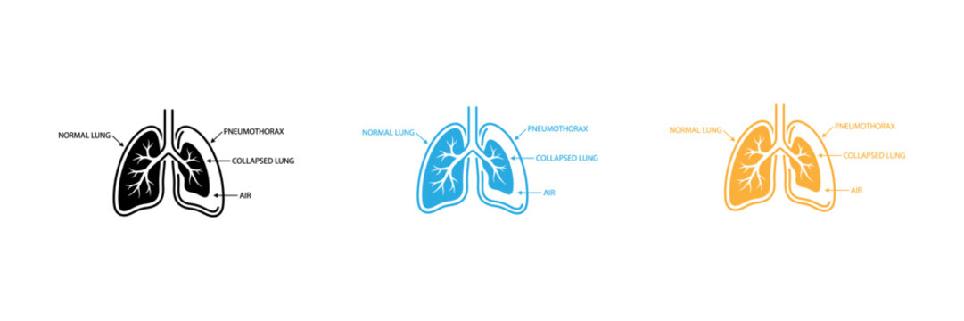 Medical illustration of lungs with oxygen flow process