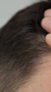 Adult Male Examines Forehead Hairline Thoroughly Before Mirror. Individual Touches Dark Brown Strands Carefully With Fingers, Displaying Serious Emotion Regarding Baldness And Hair Health.