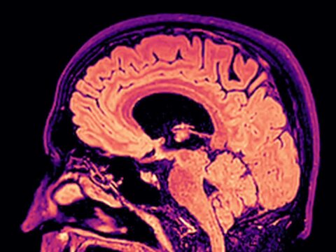 Sagittal brain MRI scan animation with colorful heat map, neuroimaging of human brain anatomy, cerebrum, cerebellum and brainstem