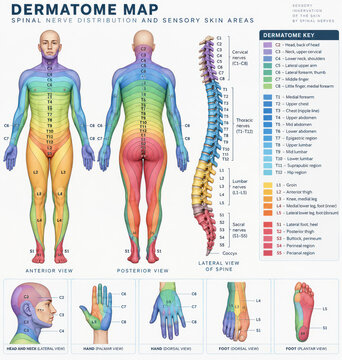 Dermatome Map of Spinal Nerves and Sensory Skin Distribution