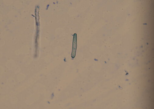 soil microorganisms under a microscope including amoeba, flagellates, nematodes, fungi, bacteria