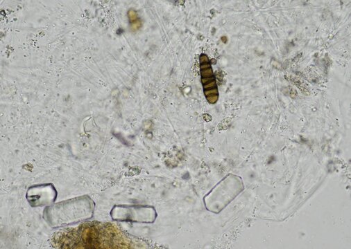 soil microorganisms under a microscope including amoeba, flagellates, nematodes, fungi, bacteria