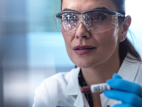 Woman examines blood sample during neurology clinical trial in lab