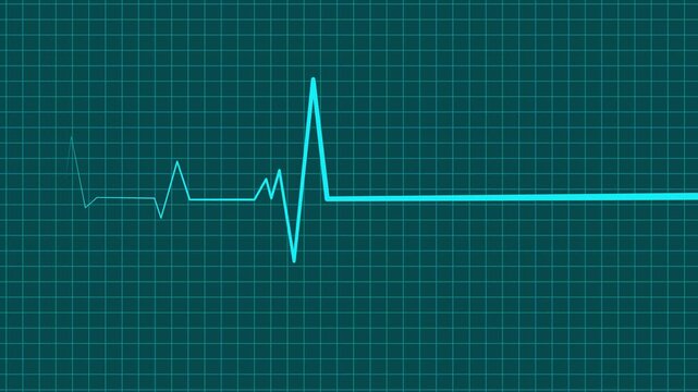 Electrocardiogram Heartbeat Wave Animation with Medical Signal Line