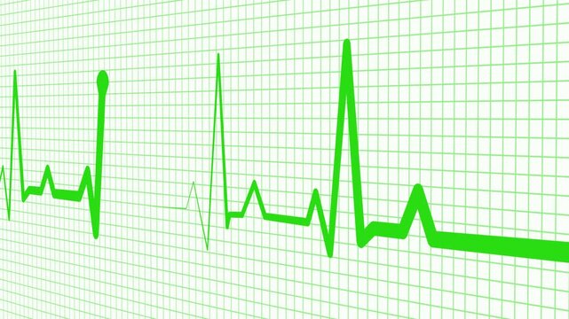 Digital ECG Line Animation for Medical and Healthcare Presentations