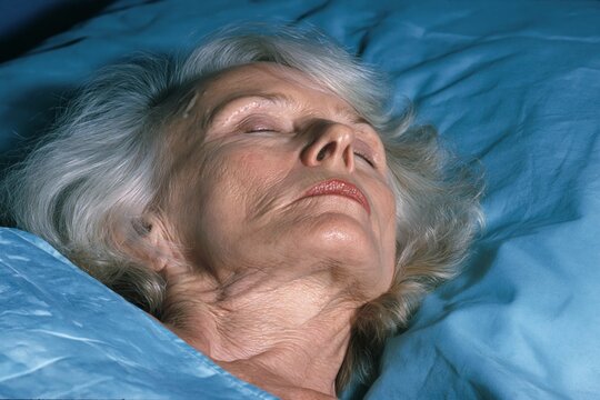 Elderly woman sleeping peacefully in hospital bed with blue covers under warm lighting