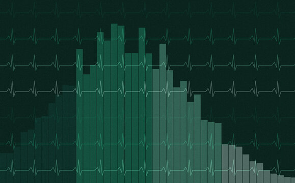 Heartbeat line graph over bar chart histogram for medical health monitoring and clinical data assessment.