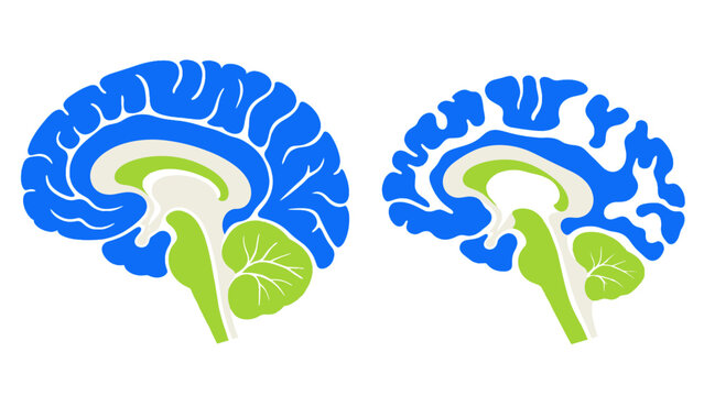 Two sagittal brain cross sections with cerebellum and brainstem