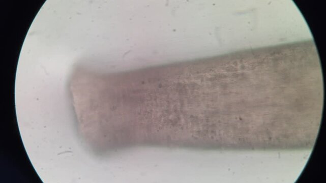 Tangled Chemically Depilated Pubic Hair Fibers Curving Across Microscope Field
