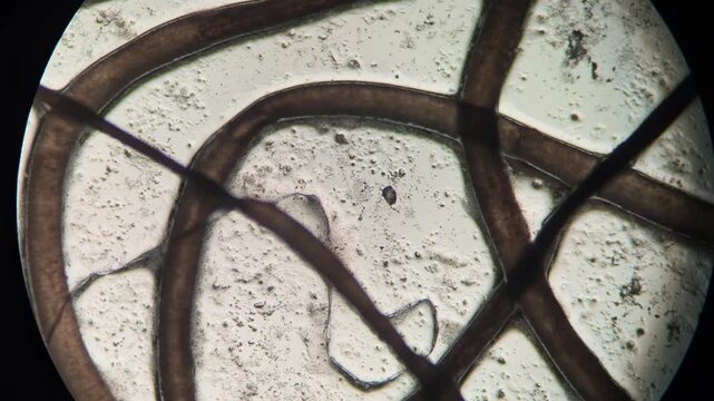 Tangled Chemically Depilated Pubic Hair Fibers Curving Across Microscope Field