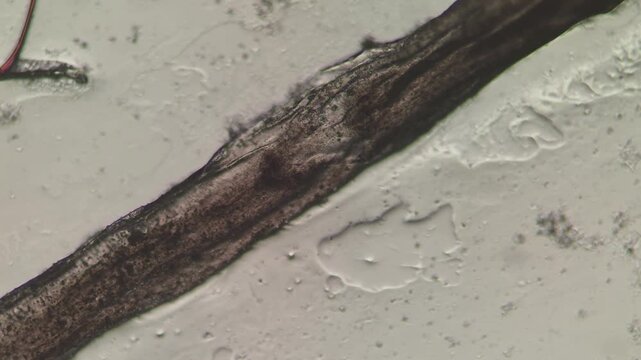 Pubic Hair Shaft Longitudinal Cortex Striations After Depilatory Cream Microscopy