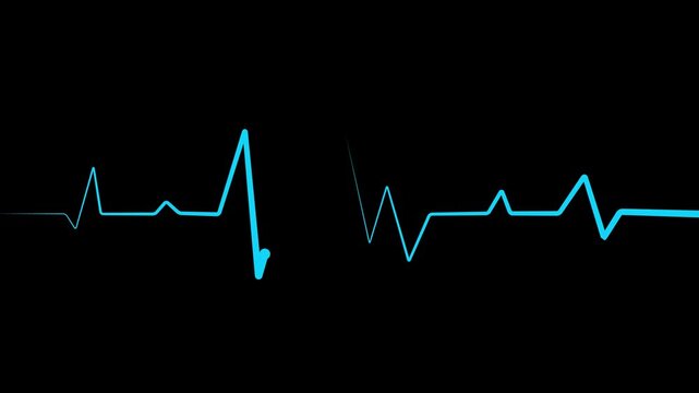 Heartbeat line white color and trace medical background. showing a medical ecg pattern heartbeat line.4k video