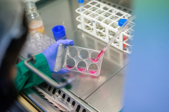 Scientist dispensing pink liquid into multiwell plate, Andaluc&iacute;a