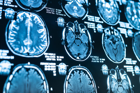 Magnetic resonance imaging scans of of the human brain
