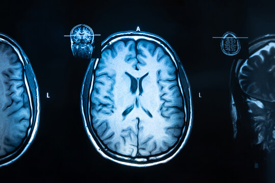 Brain MRI examination images in close up