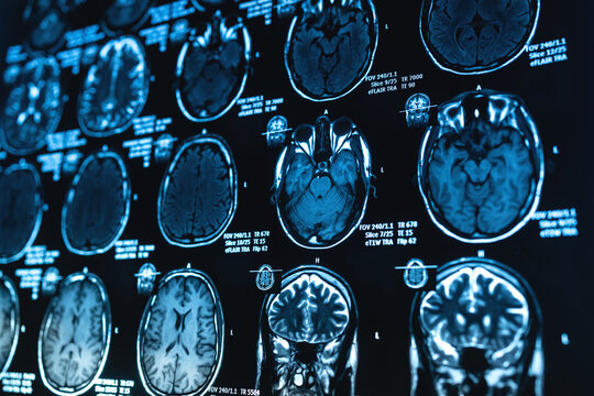 Detailed MRI brain scan images
