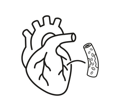 Heart and Coronary Artery Icon, Black and White Medical Symbol