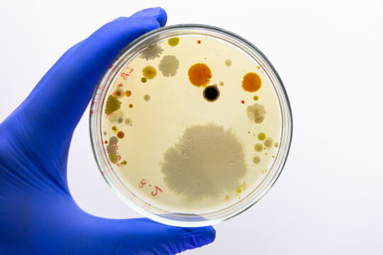 A Petri dish containing bacterial colonies of various sizes and colors; a gloved hand holds the Petri dish against a white background.