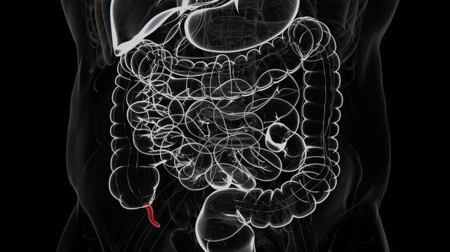 The appendix is a small, tube-shaped structure attached to the beginning of the large intestine, located near the junction of the small and large intestines in 4K UHD | Appendicitis 4K Xray Video