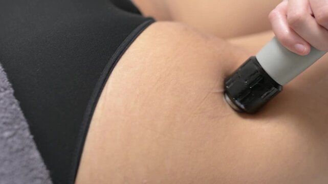 Physiotherapist using shockwave therapy on a patient's leg