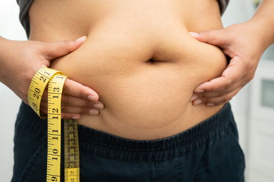 Asian woman with fat belly big size overweight and obesity with measure tape.