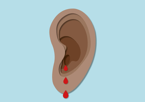 Bleeding ear, conceptual illustration