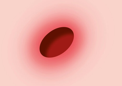 Ulcer, conceptual illustration