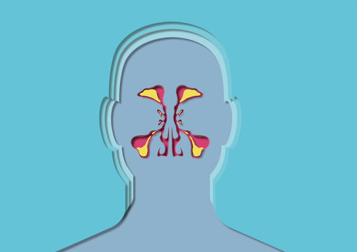 Unhealthy sinuses, conceptual illustration