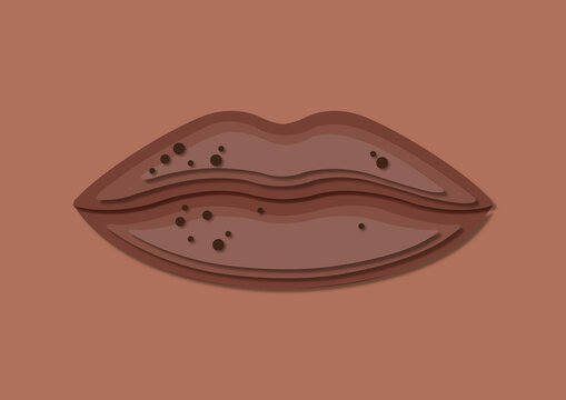 Pigment spots on lips, illustration