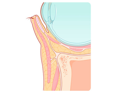 Lower eyelid anatomy, illustration