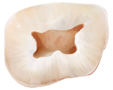 Upper first molar wide flat pulp floor, illustration