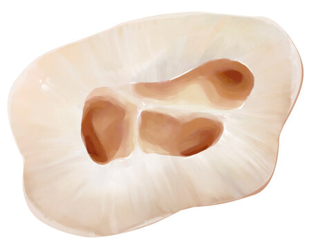 Upper 1st molar horseshoe pulp floor, illustration