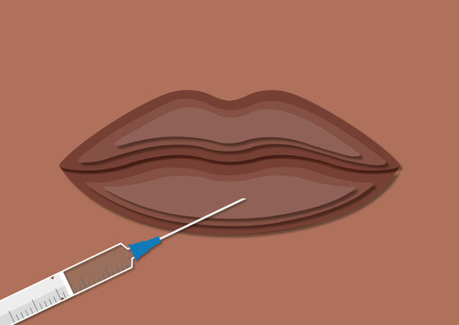 Cosmetic lip injection, conceptual illustration