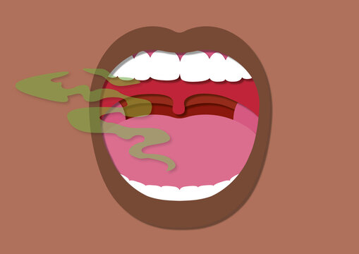 Bad breath, conceptual illustration