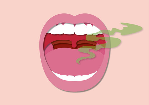 Bad breath, conceptual illustration