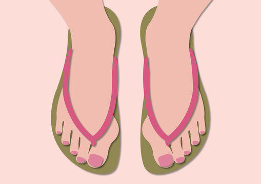 Bunions, illustration