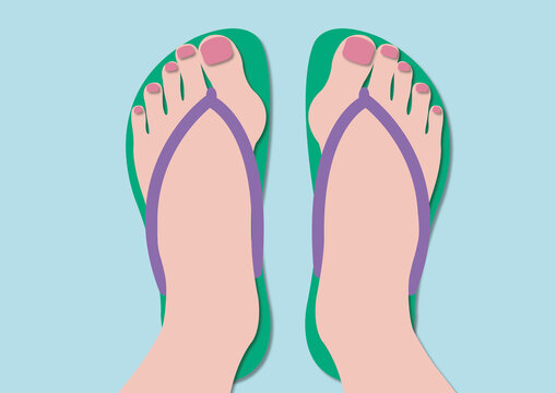 Bunions, illustration