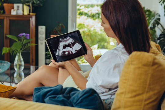 Woman looking at ultrasound picture of unborn child on couch