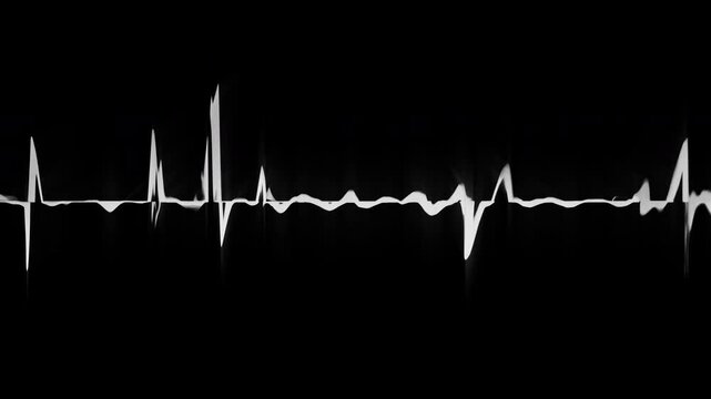 Smeared white audio waveform with glitch slices on black, AI voice assistant and speech recognition seamless vj loop