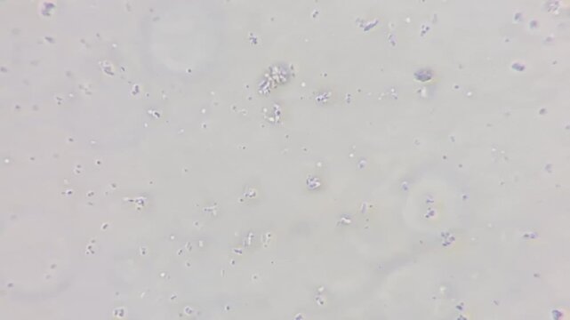 Microscopic view of bacteria causing sore throat and seasonal illness, medical microbiology lab research 