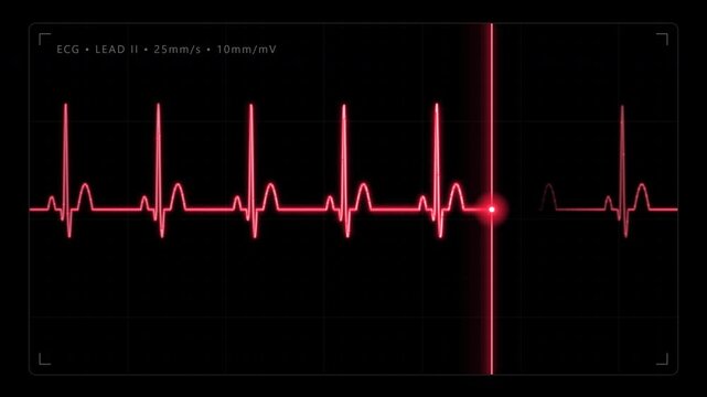 Cardiograph recording with red heart rate pulses on dark screen grid