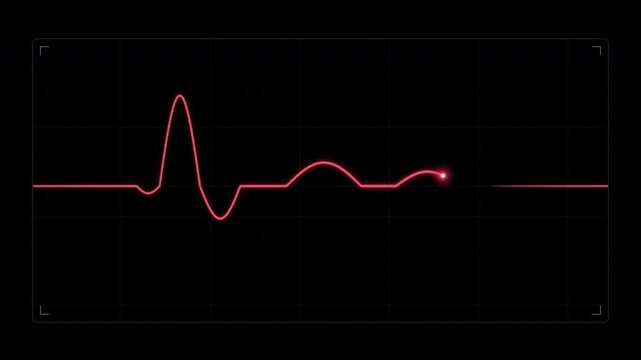 Red cardiograph recording pulses on a dark digital medical screen